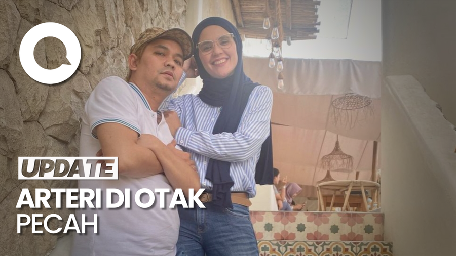 Dialami Indra Bekti, Simak Pengertian dan Gejala Perdarahan Otak