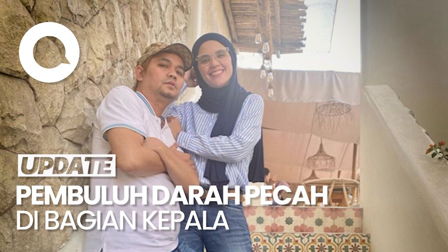 Indy Barends Bicara soal Indra Bekti Jalani Operasi