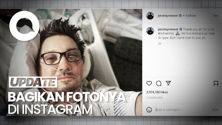 Wajah Memar Jeremy Renner Hawkeye Usai Alami Kecelakaan