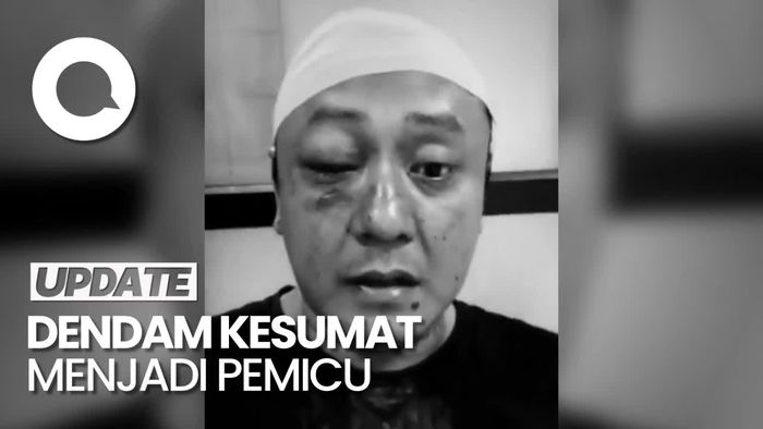 Vokalis Band Punk Asal Majalengka Dianiaya-Dibacok