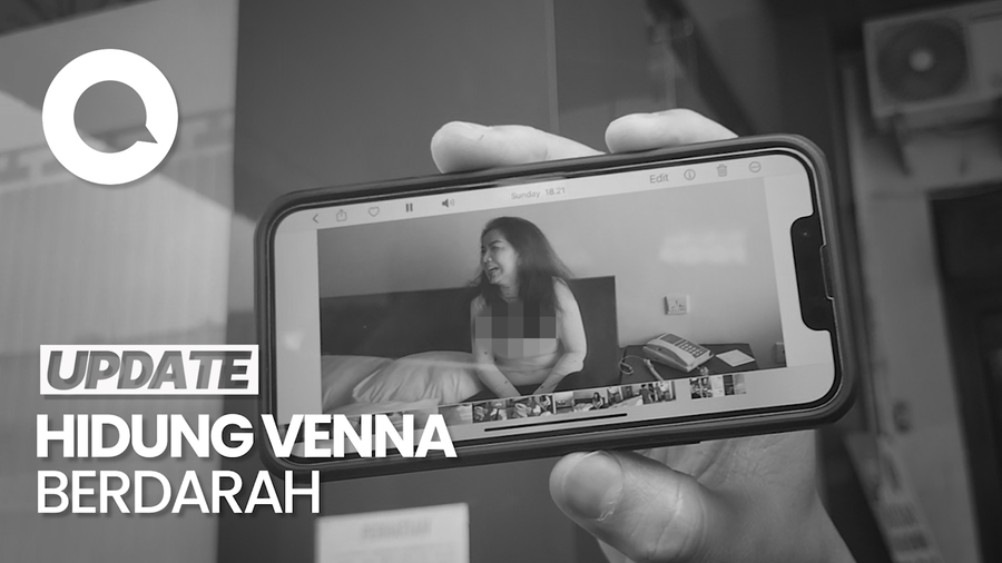 Adik Perlihatkan Video Usai Venna Melinda Diduga Di-KDRT