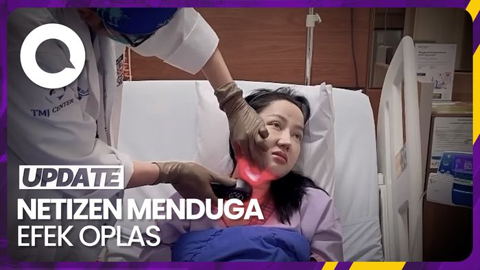 Gusi Lucinta Luna Bengkak Sampai Dilarikan ke RS