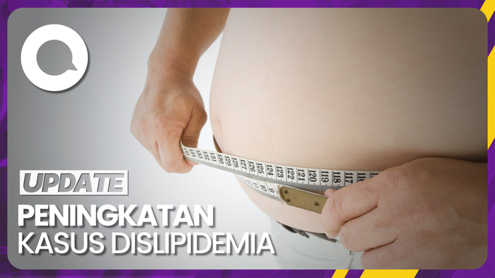 Ramai Dokter di Medsos Khawatirkan Penjualan Makanan Banyak Minyak