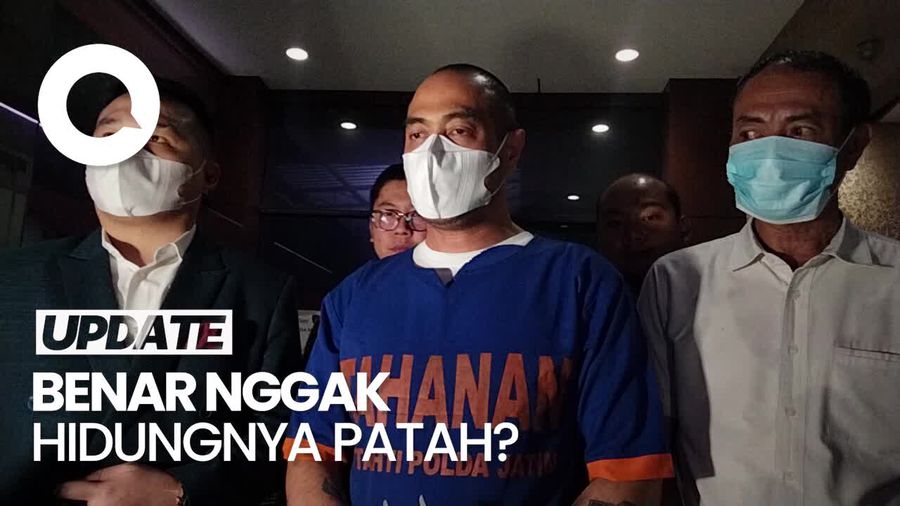 Pihak Ferry Irawan Tantang Venna Melinda Ungkap Hasil Visum