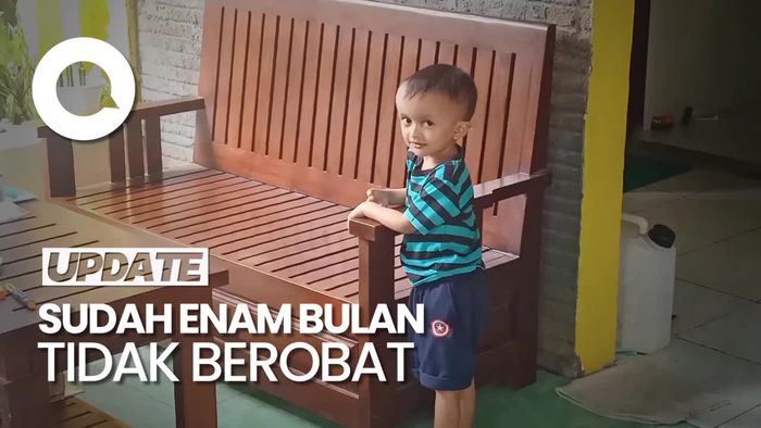 Tolong, Anak Pengidap Gangguan Hormon Kekurangan Uang untuk Berobat