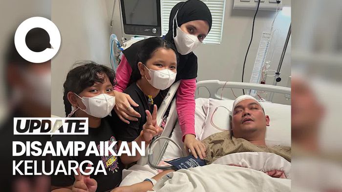 Kepala Indra Bekti Dipasang Selang Secara Permanen