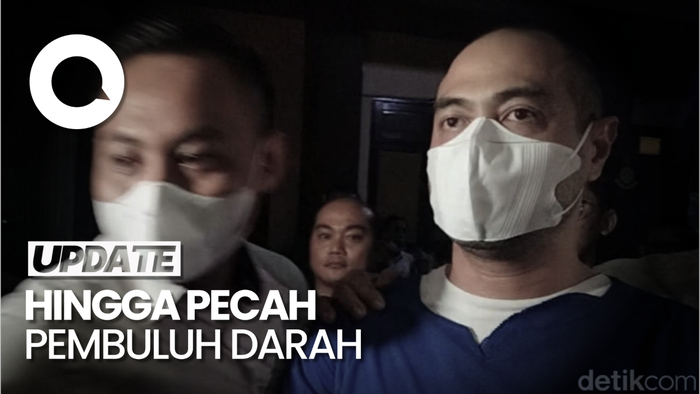 Syok dan Stresnya Ibunda Dengar Kabar Ferry Irawan KDRT Venna