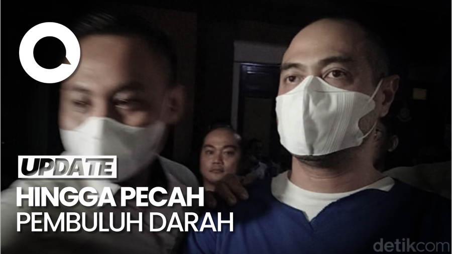 Syok dan Stresnya Ibunda Dengar Kabar Ferry Irawan KDRT Venna