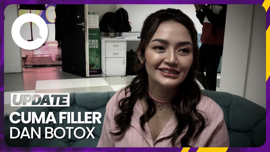 Siti Badriah Bantah Tudingan Wajahnya di Oplas