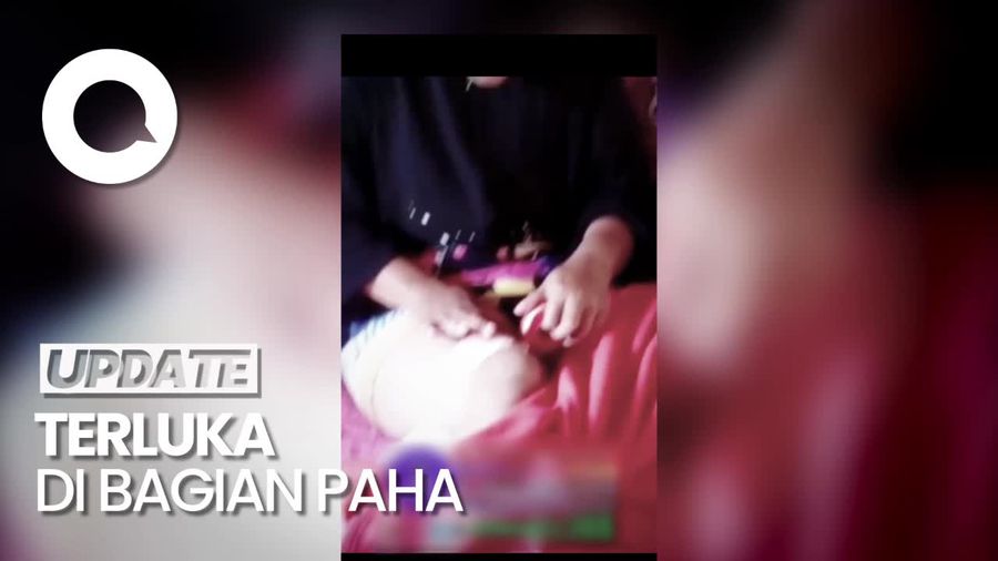 Hendak Selamatkan Anak, IRT di Sidrap Terluka Diserang OTK