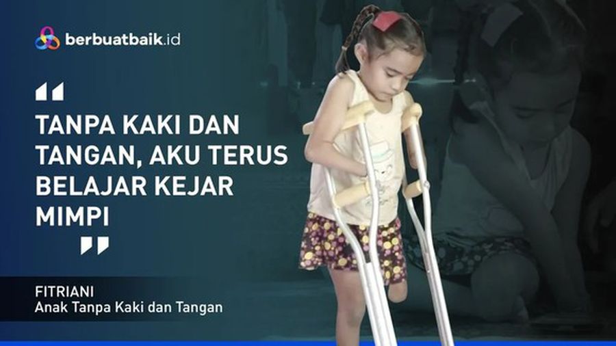 Tegarnya Fitriani, Gadis Kecil Tanpa Telapak Tangan dan Kaki