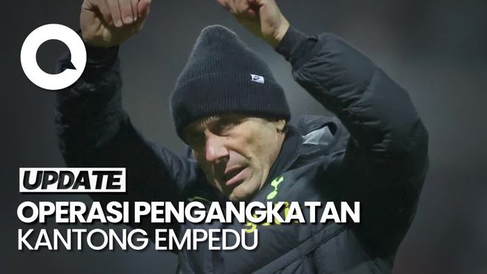 Jelang Spurs Hadapi Man City, Conte Jalani Operasi