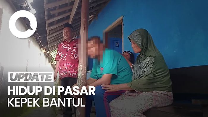 Hilang 25 Tahun Karena Takut Disunat, Bagaimana Agus Bertahan Hidup?