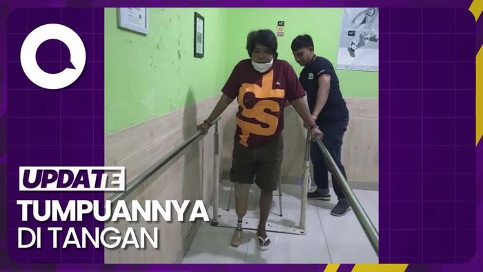 Cerita Suti Karno Berlatih Menggunakan Kaki Palsu: Enggak Mudah