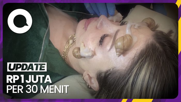 Tren Terapi Kulit Pakai Siput Albino di Suriah