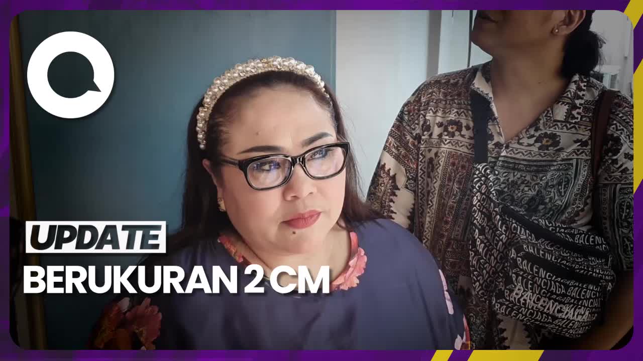 Hasil Biopsi Nunung: Kanker Payudara Stadium 2