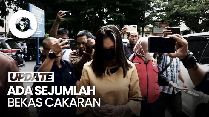 Pengacara Yakin Wanita Pedofil di Jambi Diperkosa: Ada Bekas Cengkraman