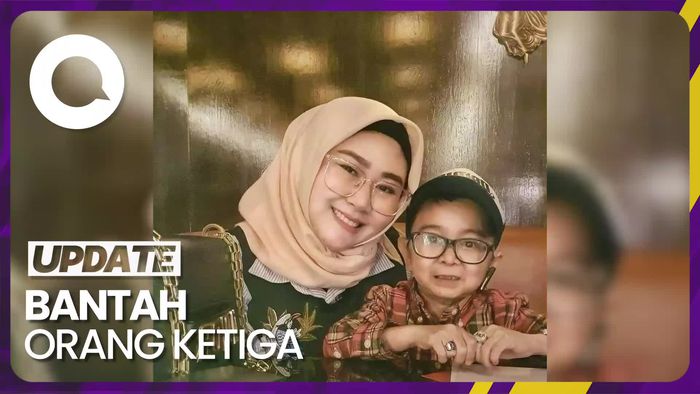 Reaksi Daus Mini Digugat Cerai Shelvie Hana