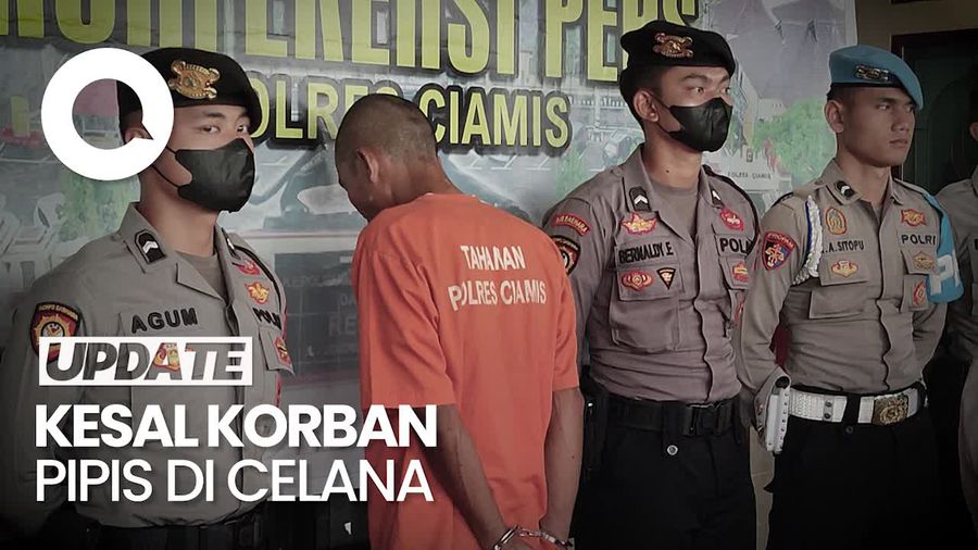 Tega! Ayah Tiri di Ciamis Siksa Anak Balitanya Gegara Pipis di Celana