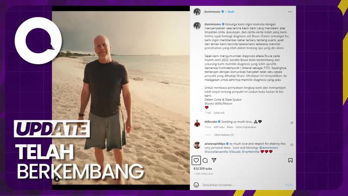 Kondisi Bruce Willis Usai Didiagnosis Demensia Frontotemporal