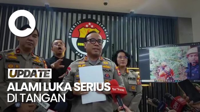 Polri: Kondisi Luka Kapolda Jambi Cukup Berat