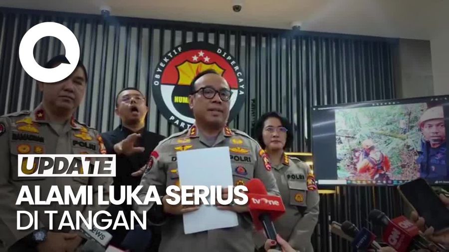 Polri: Kondisi Luka Kapolda Jambi Cukup Berat