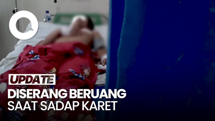 Pria di Jambi Luka Serius di Wajah Usai Gelut Lawan Beruang