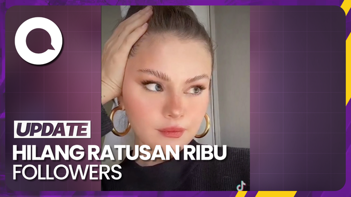 Kylie dan Hailey Di-unfollow Massal Usai Dituding Bully Selena Gomez