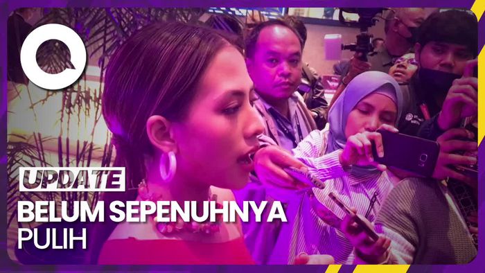 Ligamen Adhisty Zara Robek Saat Belajar Laga untuk Virgo & The Sparklings