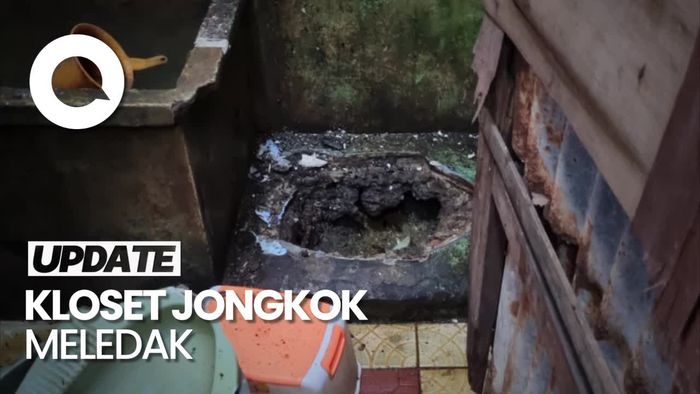 Kloset Meledak, Seorang Ibu di Duren Sawit Alami Luka Bakar