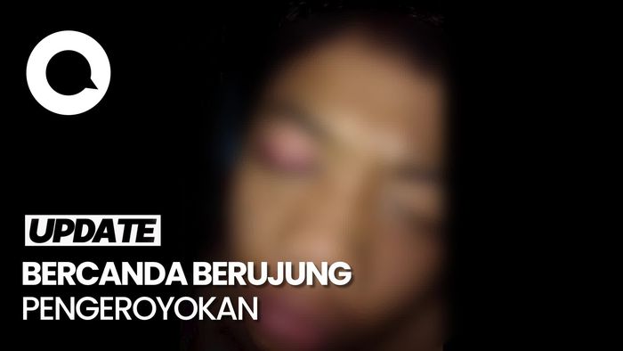 Siswa SMP di Lampung Dikeroyok Kakak Kelas, Mata Kanan Harus di Operasi