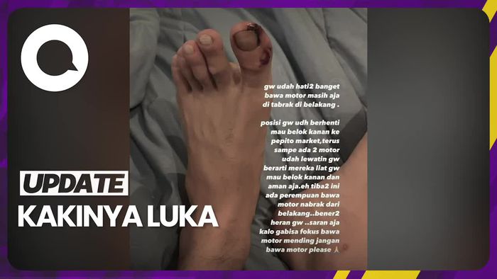 Kronologi Stefan William Ditabrak Motor dari Belakang