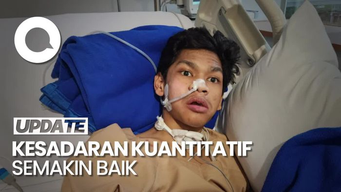 Ayah Ungkap Kondisi David Membaik: Sudah Terapi Latihan Jalan