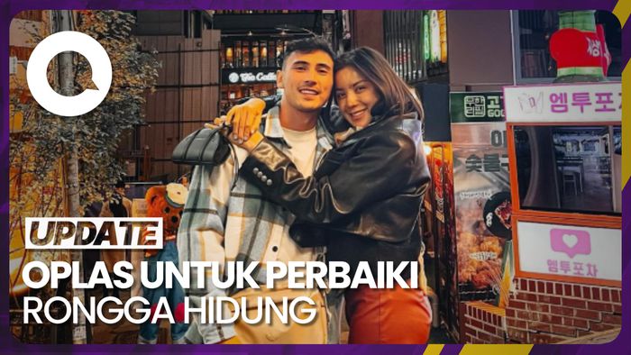Wajah Jessica Iskandar Setelah Oplas Tuai Sorotan Netizen