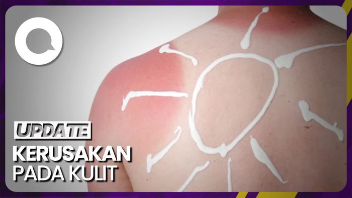 Bahaya Sinar UV Ekstrem: Sunburn hingga Kanker Kulit