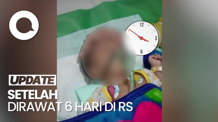 Bayi di Gresik Meninggal Setelah Kaget Dengar Ledakan Petasan