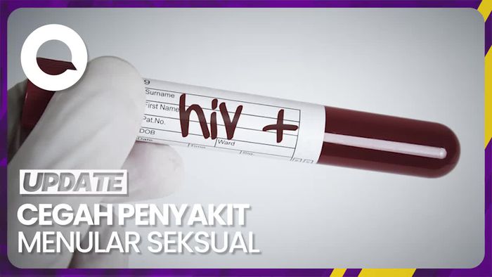 Pakar IDI Soroti Peningkatan Kasus Sifilis dan HIV di Indonesia