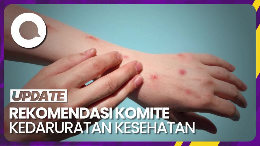 WHO Cabut Status Kedaruratan Global Cacar Monyet