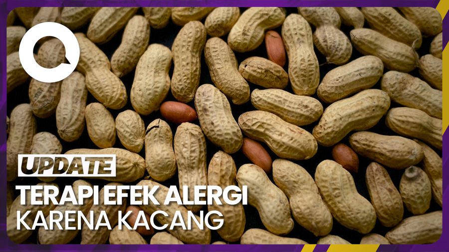 Ilmuwan Kembangkan Skin Patch untuk Obati Alergi Kacang pada Anak