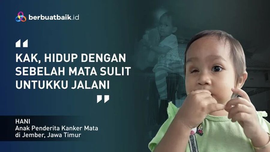 Kisah Sedih Anak Petani Usia 3 Tahun yang Kehilangan Bola Mata Akibat Kanker