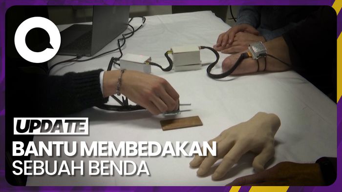 Teknologi Bionik Bantu Orang yang Diamputasi Rasakan Suhu di Tangan Prostetik