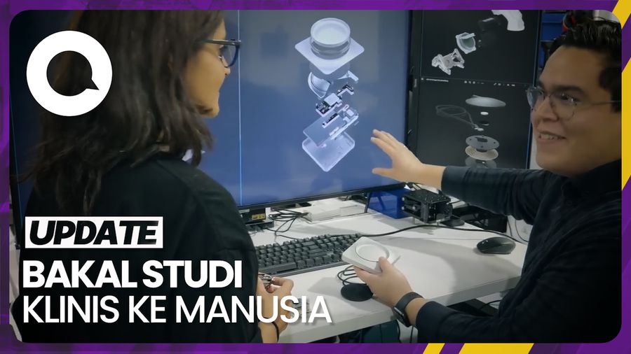 Cara Kerja Chip Otak yang Dikembangkan Elon Musk Lewat Neuralink