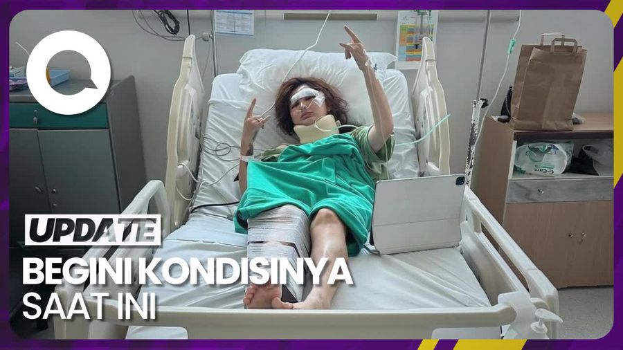 Angela Lee Alami Kecelakaan Mobil dalam Perjalanan Semarang-Yogya