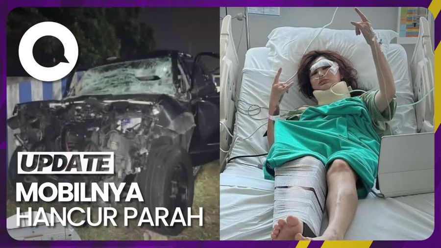 Gaya Metal Angela Lee Meski Harus Dirawat Usai Kecelakaan Mobil