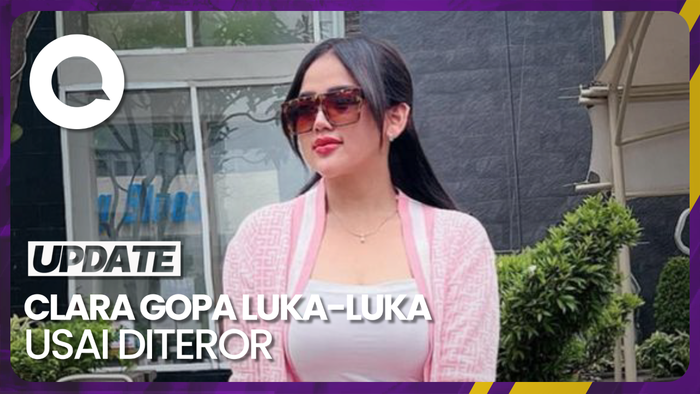 Kondisi Clara Gopa Usai Ngaku Diteror Mistis