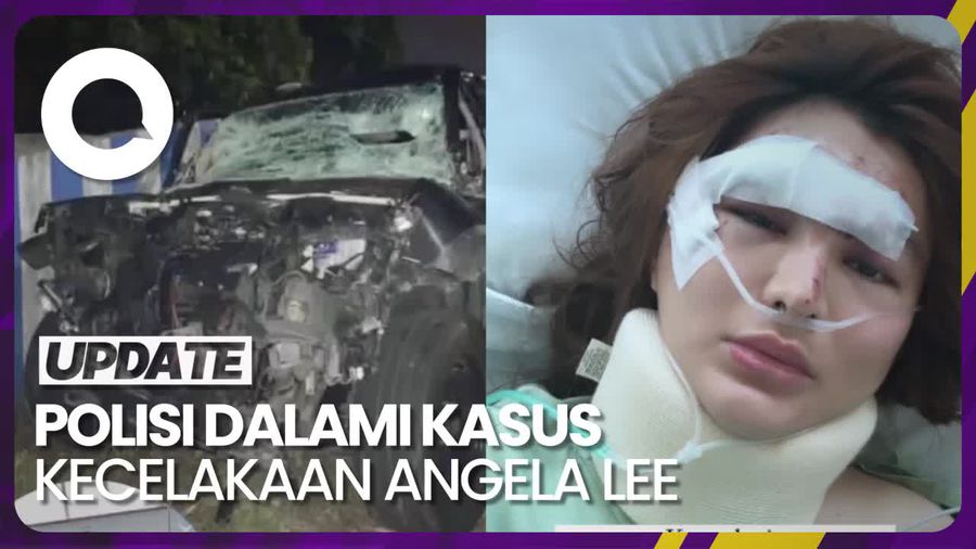 Angela Lee Kecelakaan, Sopir Diduga Nyetir saat Ngantuk
