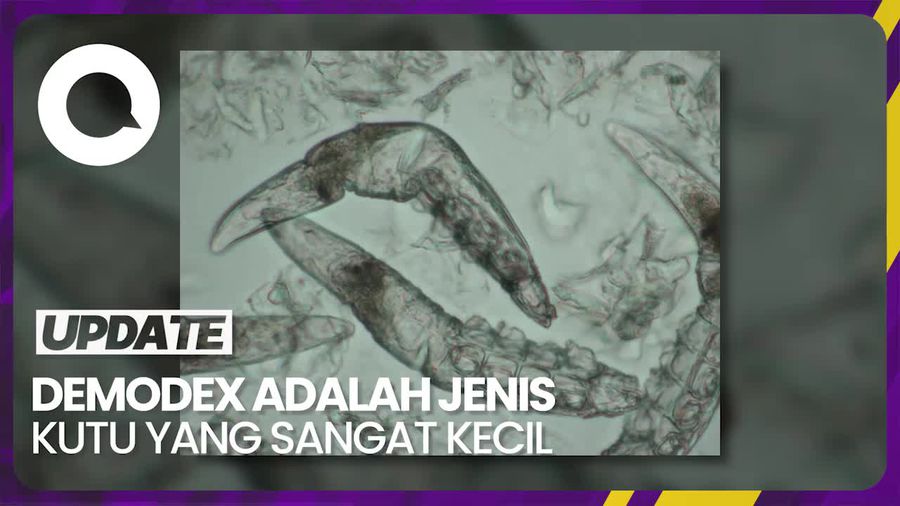 Hii.. Begini Bentuk Kutu Bulu Mata