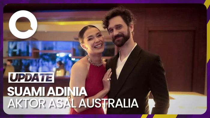Sosok Suami Adinia Wirasti yang Merupakan Aktor Asal Australia