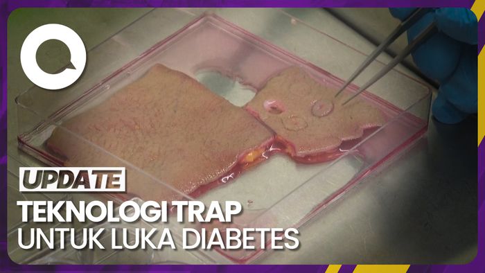 Sebuah Plester Tak Terlihat Diciptakan untuk Sembuhkan Luka Diabetes