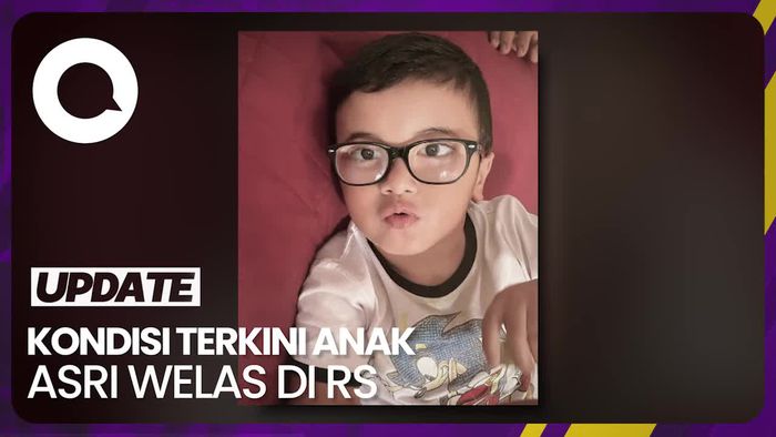 Anak Kedua Asri Welas Dirawat di ICU 